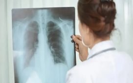 Alerta sanitaria en Entre Ríos: Los casos de tuberculosis aumentaron casi un 39% en lo que va de 2026