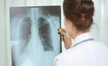 Alerta sanitaria en Entre Ríos: Los casos de tuberculosis aumentaron casi un 39% en lo que va de 2026