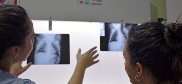 Fibrosis Quística: el diagnóstico temprano posibilita una mejor calidad de vida, estado nutricional y función pulmonar
