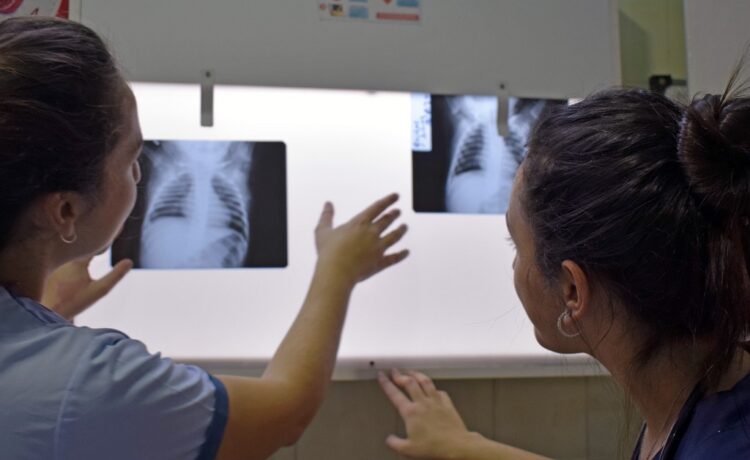 Fibrosis Quística: el diagnóstico temprano posibilita una mejor calidad de vida, estado nutricional y función pulmonar